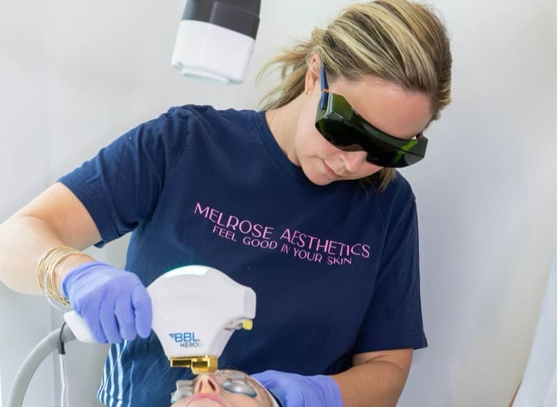 What to Expect During a BBL Photofacial in Nashville