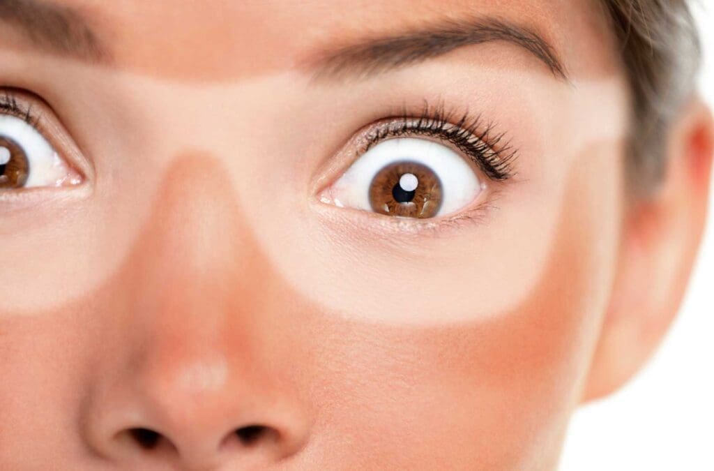 Does BBL Really Reverse Sun Damage?